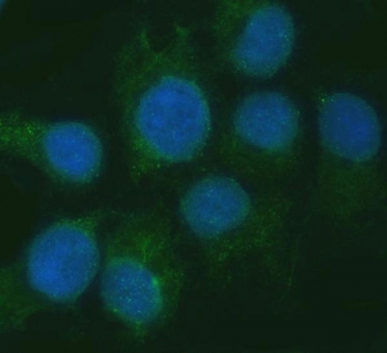 Immunofluorescent staining of FFPE human SiHa cells with RGS7 antibody (green) and DAPI nuclear stain (blue). HIER: steam section in pH6 citrate buffer for 20 min.