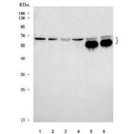 Western blot testing of 1) human U-87 MG, 2) human SH-SY5Y, 3) human SK-N-SH, 4) human U-251, 5) rat brain and 6) mouse brain tissue lysate with RGS7 antibody. Predicted molecular weight: 49-57 kDa (multiple isoforms).