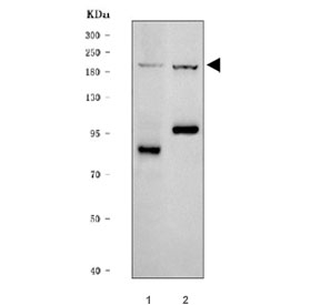 Western blot testing of 1) human SH-SY5Y and 2) rat H9C2(2-1) cell lysate with ADAMTS9 antibody. Expected molecular weight: 120-216 kDa (multiple isoforms).