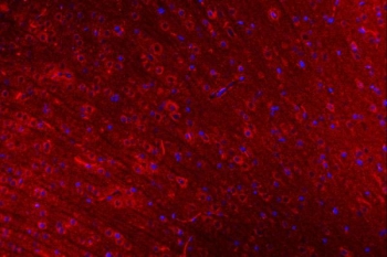 Immunofluorescent staining of FFPE rat brain tissue with CLASP1 antibody (red) and DAPI nuclear stain (blue). HIER: steam section in pH8 EDTA buffer for 20 min.
