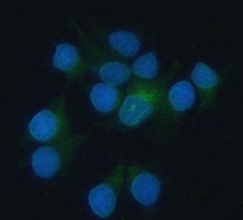 Immunofluorescent staining of FFPE human MCF7 cells with HO-2 antibody (green) and DAPI nuclear stain (blue). HIER: steam section in pH6 citrate buffer for 20 min.