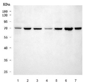 Western blot testing of 1) rat brain, 2) rat heart, 3) rat C6, 4) mouse brain, 5) mouse heart, 6) mouse Neuro-2a and 7) mouse C2C12 cell lysate with Adgrg1 antibody. Predicted molecular weight ~78 kDa.