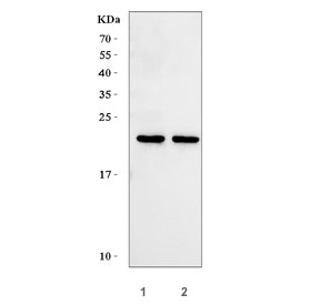Western blot testing of human 1) HepG2 and 2) U-87 MG cell lysate with TNNI1 antibody. Predic