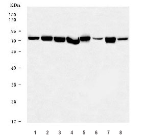 Western blot testing of 1) human HeLa, 2) human MCF7, 3) human HepG2, 4) human PANC-1, 5) rat liver, 6) rat brain, 7) mouse liver and 8) mouse brain tissue lysate with PDIA4 antibody. Predicted molecular weight ~73 kDa.