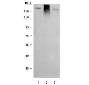 Western blot testing of human 1) A549, 2) Caco-2 and 3) PC-3 cell lysate with NKCC1 antibody. Expected molecular weight ~130 kDa but may be observed at higher molecular weights due to glycosylation.