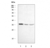 Western blot testing of human 1) SW620, 2) 293T and 3) HepG2 cell lysate with Homeobox A4 antibody. Predicted molecular weight ~35 kDa.