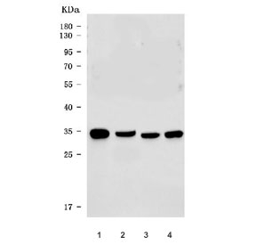 Western blot testing of 1) human HepG2, 2) human HeLa, 3) rat liver and 4)