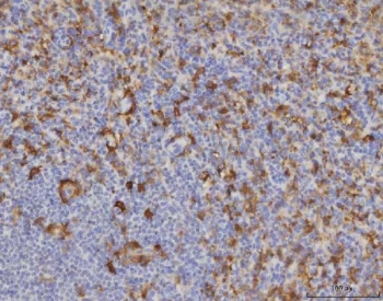IHC staining of FFPE human spleen tissue with Malic enzyme 1 antibody. HIER: boil tissue sections in pH8 EDTA for 20 min and allow to cool before testing.