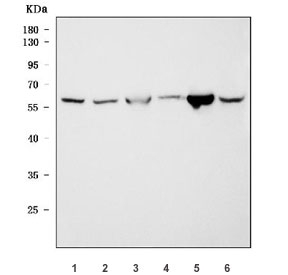 Western blot testing of 1) human A549, 2) human HeLa, 3) rat testis, 4) rat brain, 5) mouse testis and 6) mouse brain tissue lysate with Malic enzyme 1 antibody. Predicted molecular weight ~64 kDa and ~55 kDa (two isoforms).