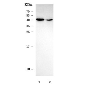 Western blot testing of human 1) MOLT4 and 2) U-251 cell lysate with RHNO1 an