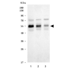 Western blot testing of human 1) HepG2, 2) 293T and 3) A431 cell lysate with X-ray repair cross-complementing 4 antibody. Predicted molecular weight: 35-38/55 kDa (unmodified/phosphorylated).