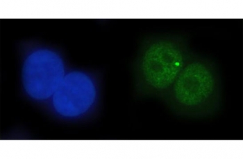 Immunofluorescent staining of FFPE human A549 cells with EAP2 antibody (green) and DAPI nuclear stain (blue). HIER: steam section in pH6 citrate buffer for 20 min.~