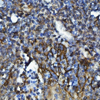 IHC staining of FFPE human tonsil tissue with CXCR7 antibody. HIER: boil tissue sections in pH8 EDTA for 20 min and allow to cool before testing.