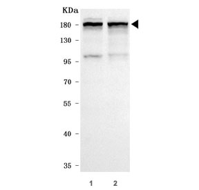 Western blot testing of human 1) HeLa and 2) A549 cell lysate with INF2 antibody. Predicted molecular weight ~136 kDa, routinely observed at 170-180 kDa.