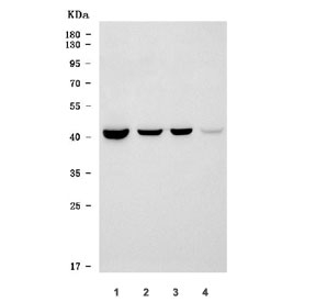 Wester blot testing of 1) rat liver, 2) rat RH35, 3) mouse liver and 4) mouse small intestine tissue lysate with TM6SF2 antibody. Predicted molecular weight ~43 kDa.