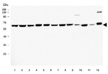 Western blot testing of 1) human MCF7, 2) human HeLa, 3) human A549, 4) human PC-3, 5) human A431, 6) human U-87 MG, 7) human HaCaT, 8) human T-47D, 9) rat pancreas, 10) rat PC-12, 11) mouse small intestine and 12) mouse HEPA1-6 cell lysate with TFG antibody. Predicted molecular weight ~43 kDa, commonly observed at 50-60 kDa.