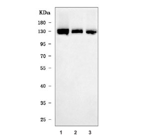 Western blot testing of human 1) Caco-2, 2) A549 and 3) HaCaT cell lysate with ZNRF3 antibody. Predicted molecular weight ~101 kDa.
