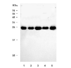 Western blot testing of 1) human 293T, 2) human HeLa, 3) human Jurkat, 4) human MCF-7 and 5) rat testis tissue lysate with UBE2S antibody. Predicted molecular weight ~24 kDa.