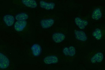 Immunofluorescent staining of FFPE human A549 cells with Tripeptidyl-peptidase 2 antibody (green) and DAPI nuclear stain (blue). HIER: steam section in pH6 citrate buffer for 20 min.
