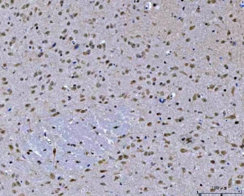 IHC staining of FFPE mouse brain tissue with ZMYND8 antibody. HIER: boil tissue sections in pH8 EDTA for 20 min and allow to cool before testing.