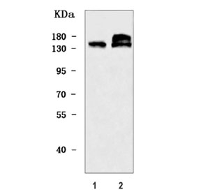 Western blot testing of human 1) 293T and 2) MCF7 cell lysate with ZMYND8 antibody. Predicted molecular weight ~132 kDa, commonly observed at 132-180 kDa.