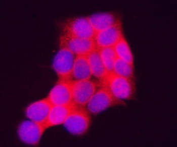 Immunofluorescent staining of FFPE human MCF7 cells with INPP4A antibody (red) and DAPI nuclear stain (blue). HIER: steam section in pH6 citrate buffer for 20 min.~