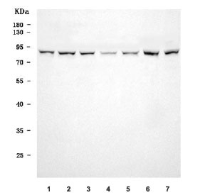 Western blot testing of human 1) RT4, 2) U-251, 3) Daudi, 4) MOLT4, 5) MCF