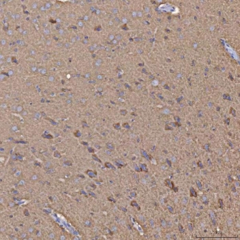 IHC staining of FFPE rat brain tissue with Selenophosphate synthetase 1 antibody. HIER: boil tissue sections in pH8 EDTA for 20 min and allow to cool before testing.~