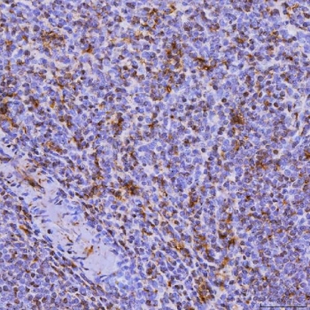 IHC staining of FFPE human spleen tissue with Septin 6 antibody. HIER: boil tissue sections in pH8 EDTA for 20 min and allow to cool before testing.