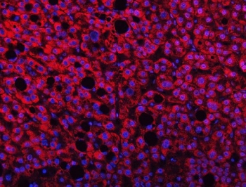 Immunofluorescent staining of FFPE human liver cancer tissue with TMPRSS13 antibody (red) and DAPI nuclear stain (blue). HIER: steam section in pH8 EDTA buffer for 20 min.