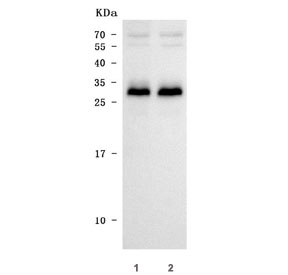 Western blot testing of human 1) MOLT4 and 2) Jurkat cell lysate with TRAT1