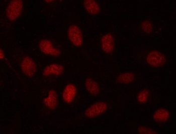 Immunofluorescent staining of FFPE human U-2 OS cells with SDE2 antibody (red). HIER: steam section in pH6 citrate buffer for 20 min.