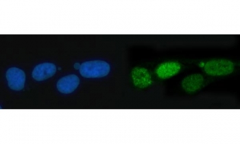 Immunofluorescent staining of FFPE human U-2 OS cells with TIGD1 antibody (green) and DAPI nuclear stain (blue). HIER: steam section in pH6 citrate buffer for 20 min.