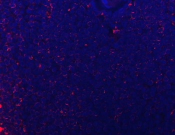 Immunofluorescent staining of FFPE human spleen tissue with CD74 antibody (red) and DAPI nuclear stain (blue). HIER: steam section in pH8 EDTA buffer for 20 min.
