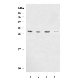 Western blot testing of human 1) HeLa, 2) 293T, 3) Jurkat and 4) A549 cell l
