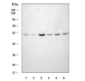Western blot testing of human 1) Jurkat, 2) Raji, 3) K562, 4) RT4, 5) HEL an