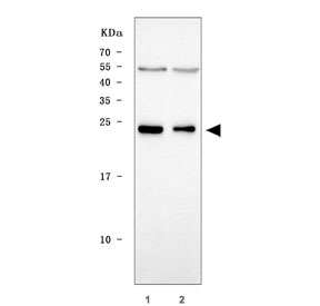 Western blot testing of human 1) MOLT4 and 2) U937 cell lysate with NARF antibody. Predicted molecular weight ~28 kDa.