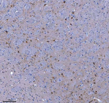 IHC staining of FFPE mouse brain tissue with TRANK1 antibody. HIER: boil tissue sections in pH8 EDTA for 20 min and allow to cool before testing.