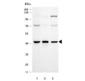 Western blot testing of human 1) HepG2, 2) Daudi and 3) HEL cell lysate with MRPP1 antibody. Predicted molecular weight ~47 kDa, commonly observed at 40-47 kDa.