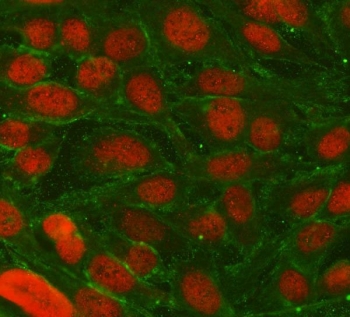 Immunofluorescent staining of FFPE human U-2 OS cells with TRIM36 antibody (red) and Alpha Tubulin mAb (green). HIER: steam section in pH6 citrate buffer for 20 min.