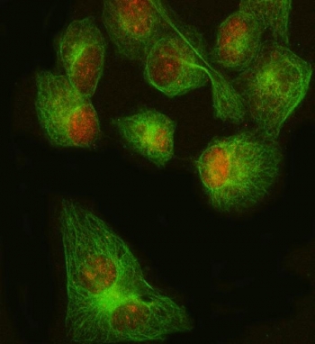 Immunofluorescent staining of FFPE human HeLa cells with FOXP1 antibody (red) and Beta Tubulin antibody (green). HIER: steam section in pH6 citrate buffer for 20 min.~