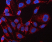 Immunofluorescent staining of FFPE human HeLa cells with EF-Tu antibody (red) and DAPI nuclear stain (blue). HIER: steam section in pH6 citrate buffer for 20 min.