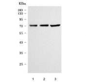 Western blot testing of 1) human Caco-2, 2) rat kidney and 3) rat PC-12 cell lysate with NaDC-1 antibody. Predicted molecular weight: 64-70 kDa (three isoforms).