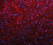 Immunofluorescent staining of FFPE mouse brain tissue with RIMS-binding protein 2 antibody (red) and DAPI nuclear stain (blue). HIER: steam section in pH8 EDTA buffer for 20 min.