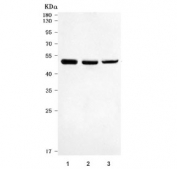 Western blot testing of 1) rat brain, 2) mouse brain and 3) mouse NIH 3T3 cell lysate with Death receptor 5 antibody. Expected molecular weight: ~40 kDa (mature form) and ~48 kDa (precursor). This protein may also be visualized at ~60 kDa.