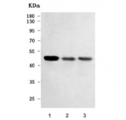 Western blot testing of human 1) U-251, 2) U-87 MG and 3) U-2 OS cell lysate with RTL3 antibody. Predicted molecular weight ~53 kDa.