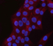 Immunofluorescent staining of FFPE human U-2 OS cells with PNPLA6 antibody (red) and DAPI nuclear stain (blue). HIER: steam section in pH6 citrate buffer for 20 min.