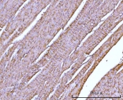 IHC staining of FFPE rat cardiac muscle tissue with NDUFA7 antibody. HIER: boil tissue sections in pH8 EDTA for 20 min and allow to cool before testing.