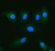 Immunofluorescent staining of FFPE human A549 cells with NADK2 antibody (green) and DAPI nuclear stain (blue). HIER: steam section in pH6 citrate buffer for 20 min.