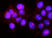 Immunofluorescent staining of FFPE human U-2 OS cells with Pancreatic lipase-related protein 2 antibody (red) and DAPI nuclear stain (blue). HIER: steam section in pH6 citrate buffer for 20 min.